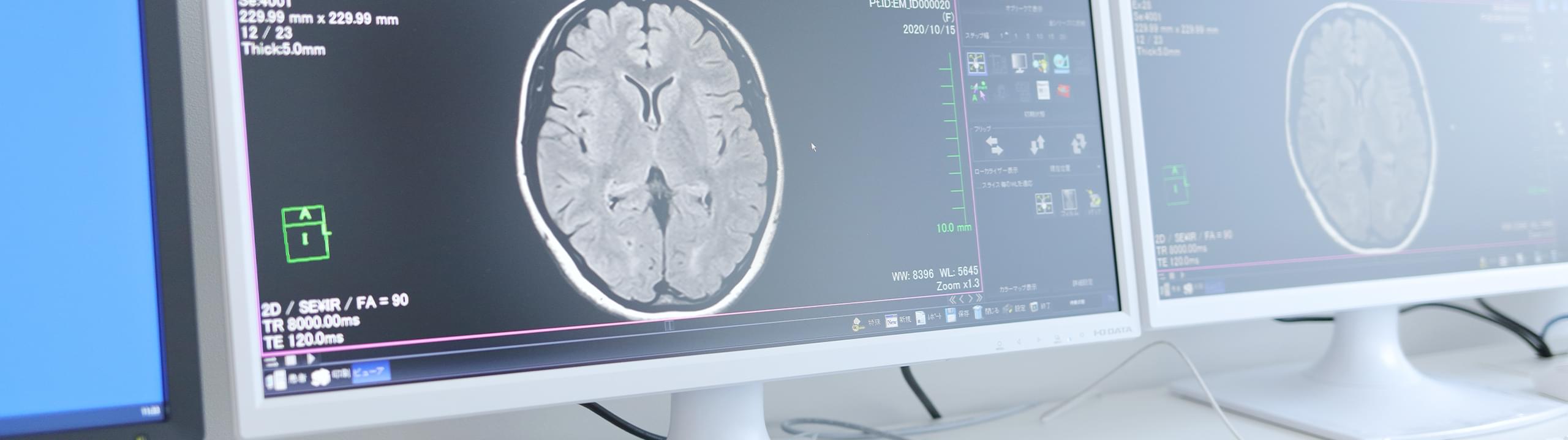 脳ドックはMRIによる脳の健康診断です。