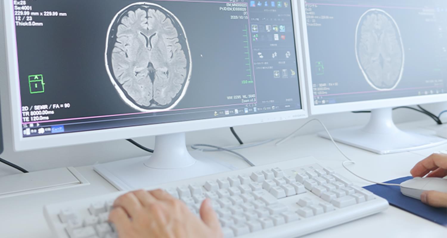 脳ドックはMRIによる脳の健康診断です。
